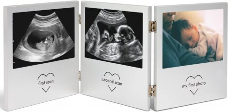 VonHaus Baby Scan Photo Frame: Multi-Photo Gender Reveal Gift for New Moms