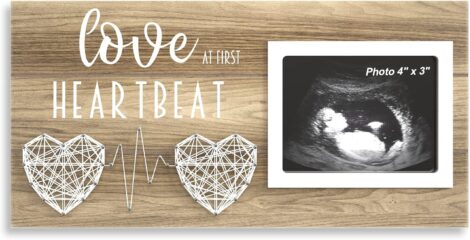 4″ x 3″ Baby Scan Photo Frames – Pregnancy Announcement and Gender Reveal Gift.